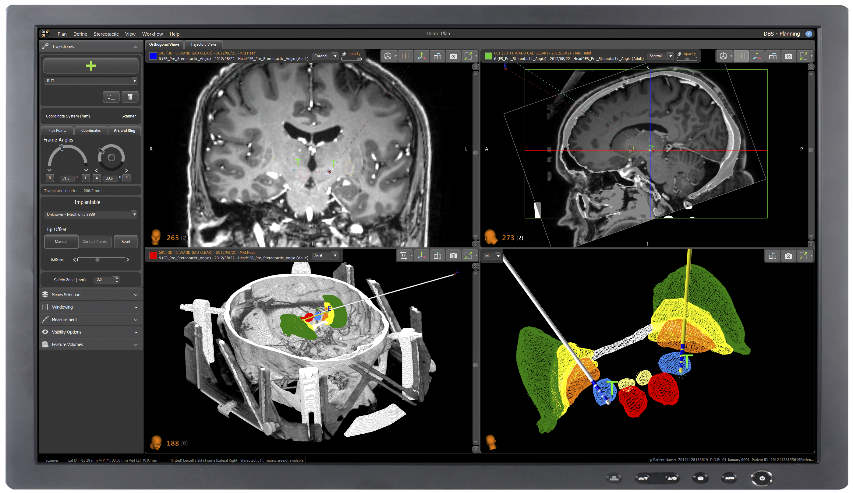 neuroinspire V5