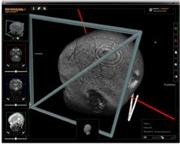 neuroinspire™ biopsy planning