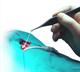 Neurosurgical operation