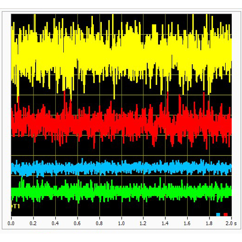 Comparison over time of jitter performance with feedback from the RESOLUTE encoder and an ultra-fine pitch competitor (cropped)