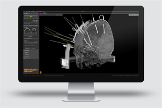 neuroinspire SEEG scan