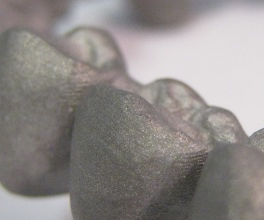 Implant bridge image