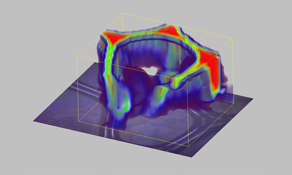 Raman image of shaving cream