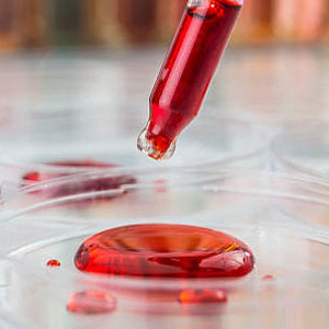 Blood sample