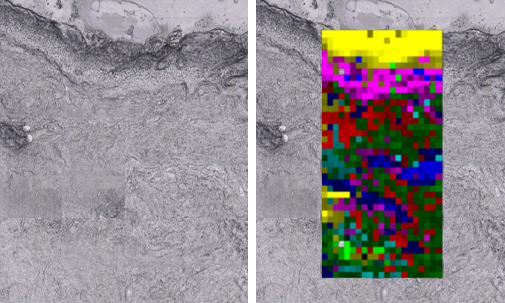 Transdermal Raman image