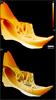Raman images of rat mandible