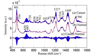 SERS_spectra_of_serum_sample